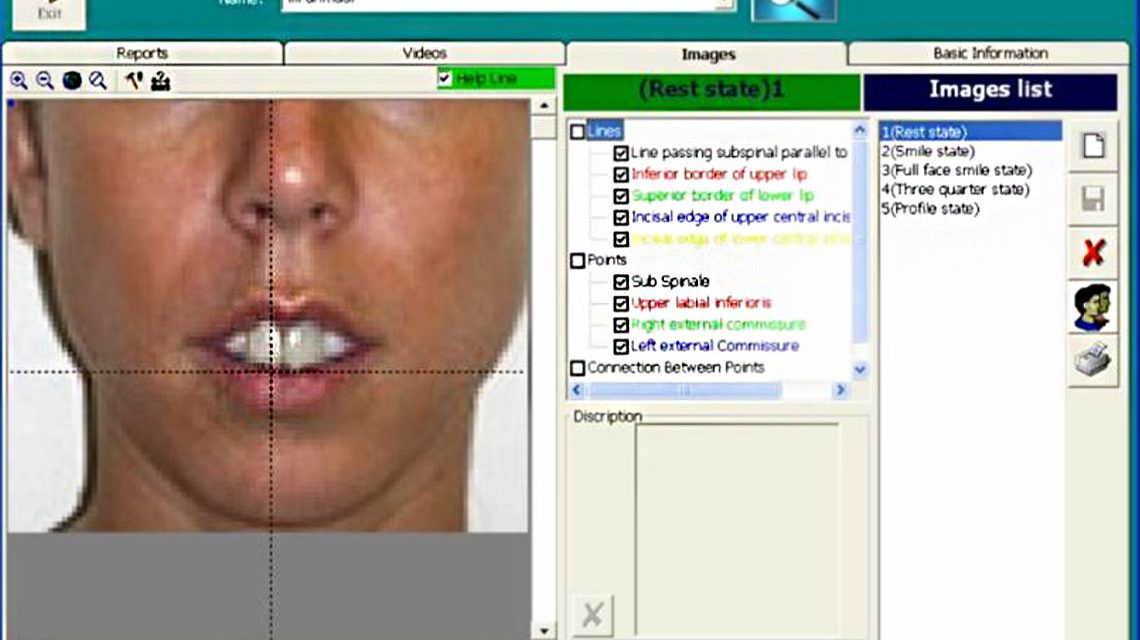 Software design for smile analysis